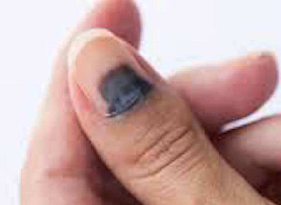 split nail