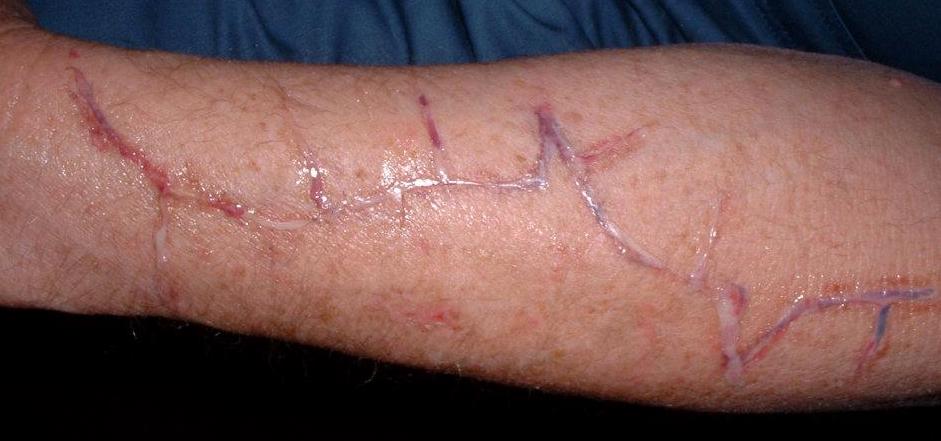 mcintaggart november 1, 2011